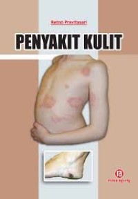 Image of Penyakit Kulit